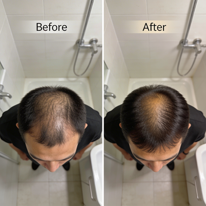 BioLume™ - Red Light Cap Therapy