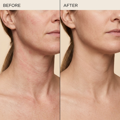 Velora™ - Retinal Shot